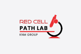 https://www.visualytes.com/wp-content/uploads/2025/05/Red-Cell-270x180.png